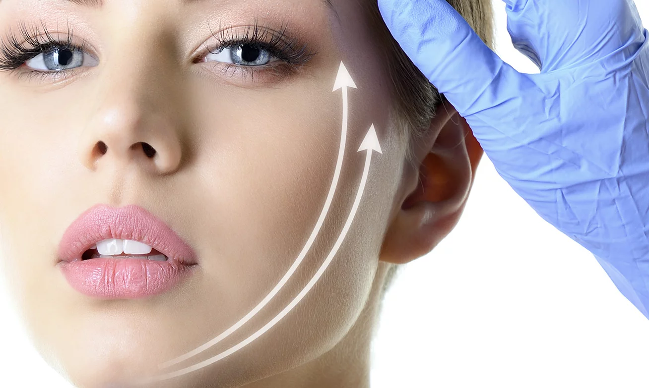 facelift blog illustratie