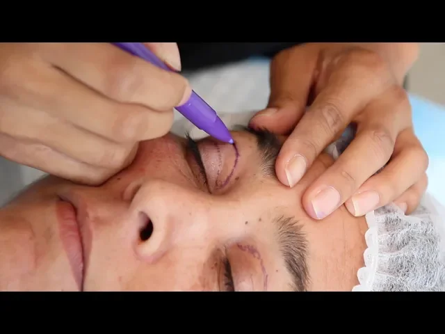 treatment video thumbnail