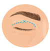 eyelid surgery sign off