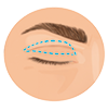 eyelid correction skin