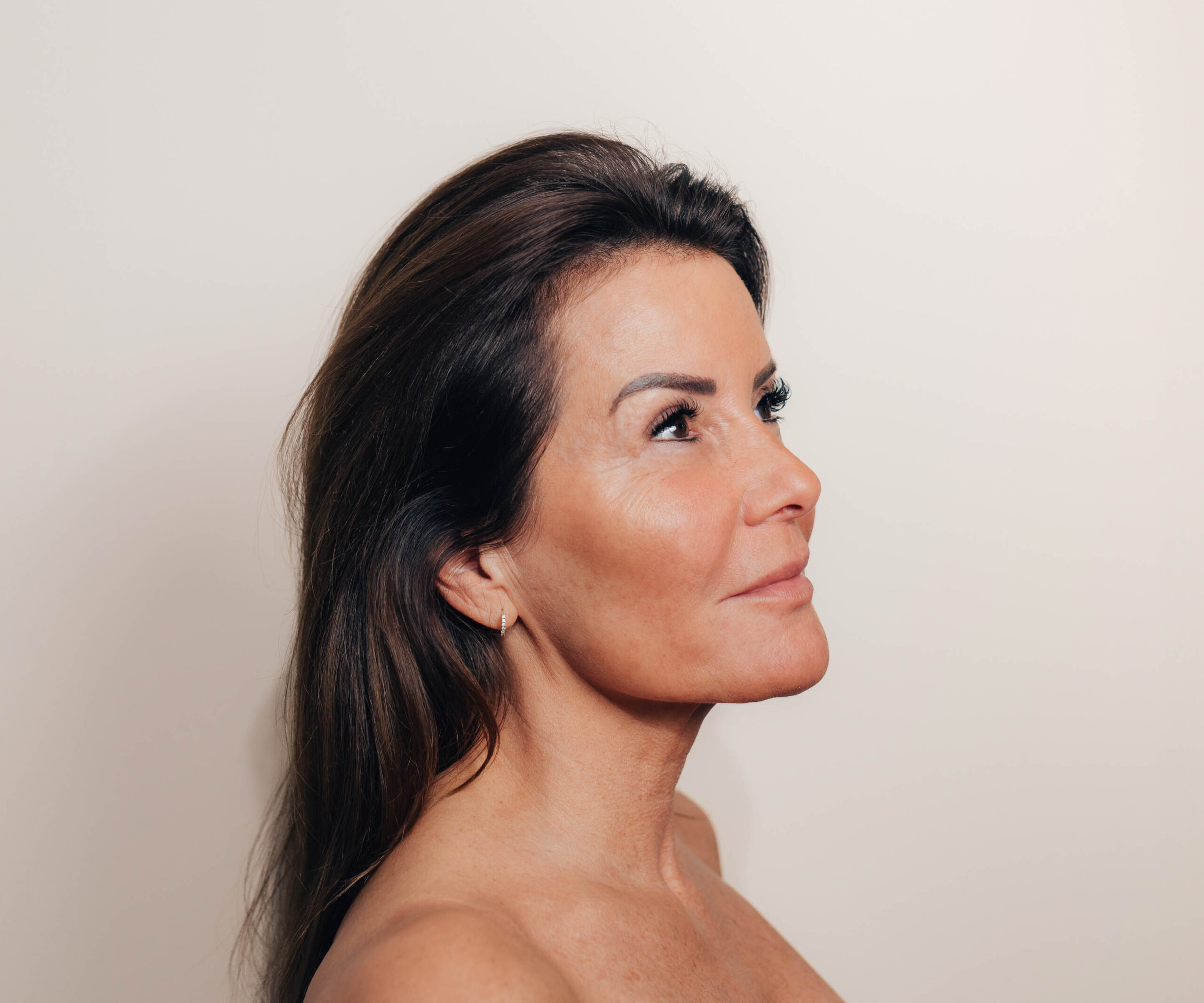 ooglidcorrectie kosten